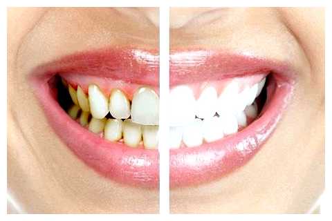 Что включает в себя сео продвижение